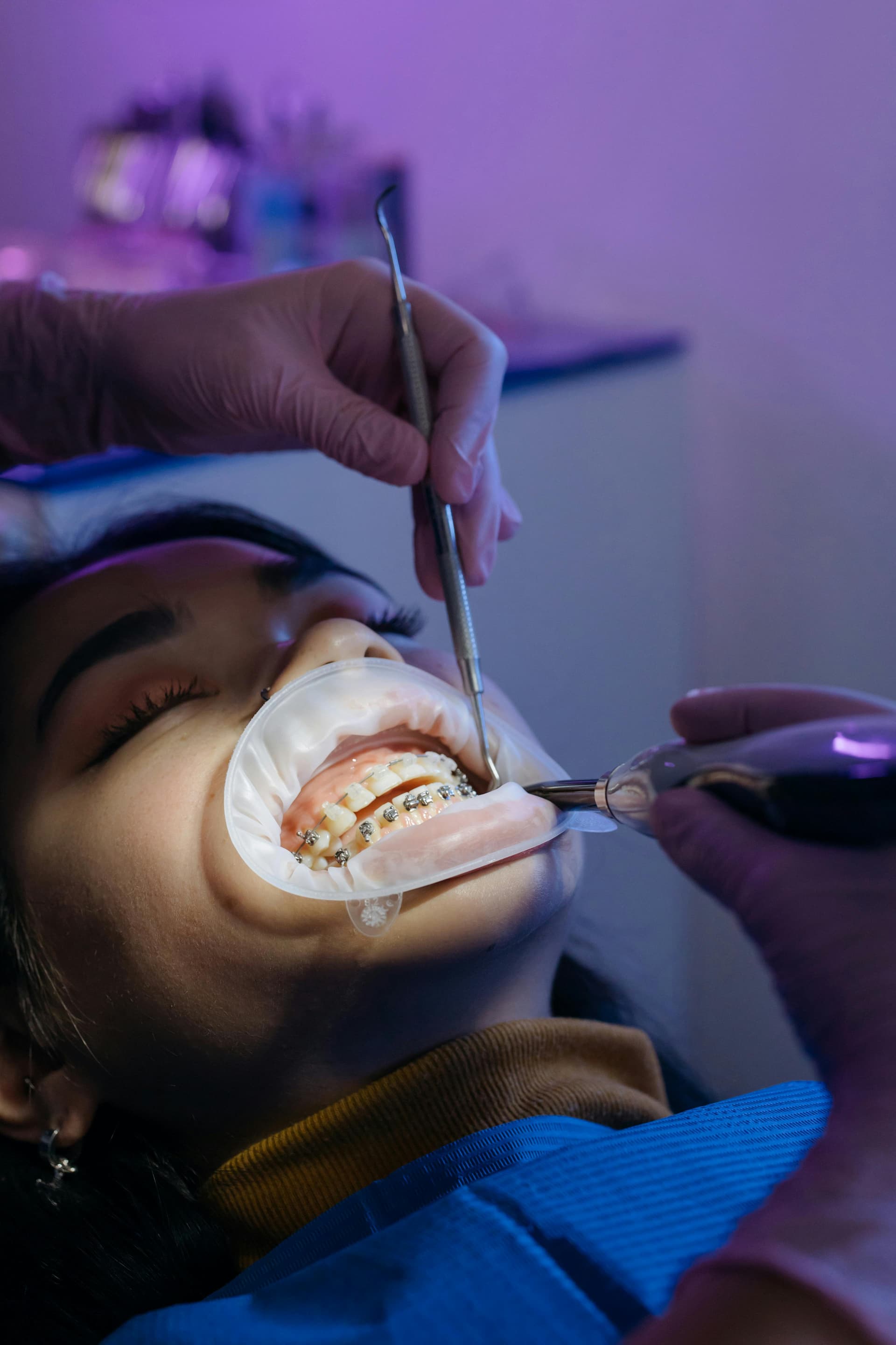 Orthodontic Treatment
