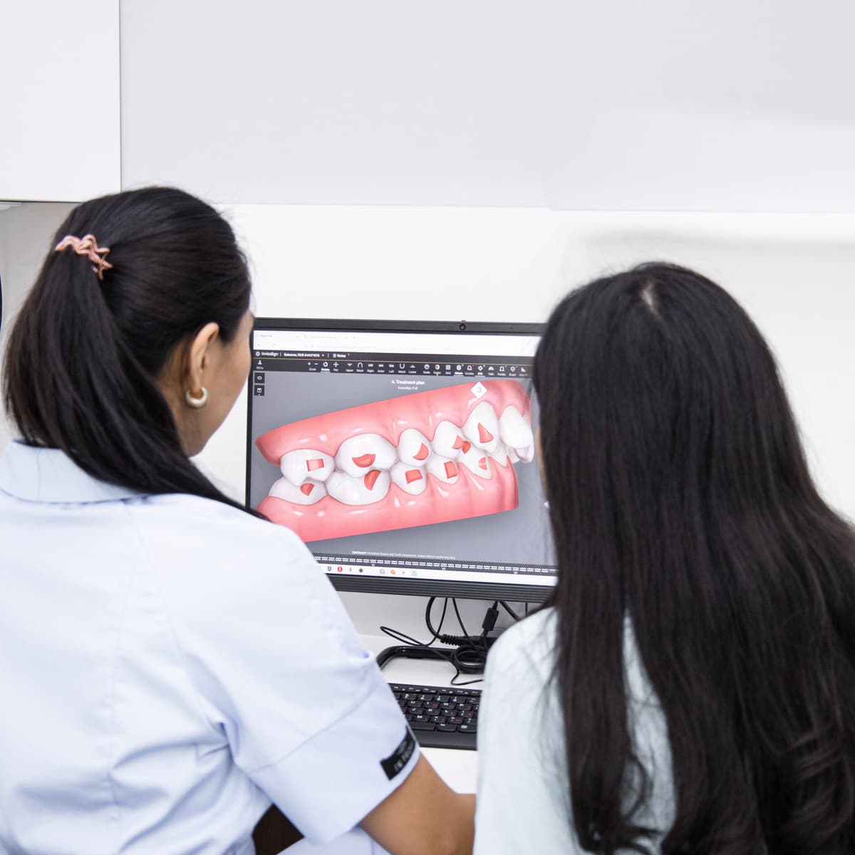 Digital Smile Design